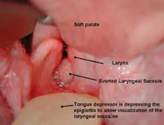 everted laryngeal saccule
