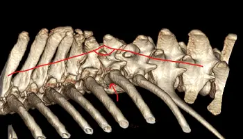 thumb-spinal -scan