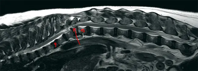 spinal-scan-dexter